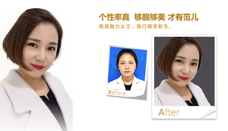 沧州美鼻、V脸