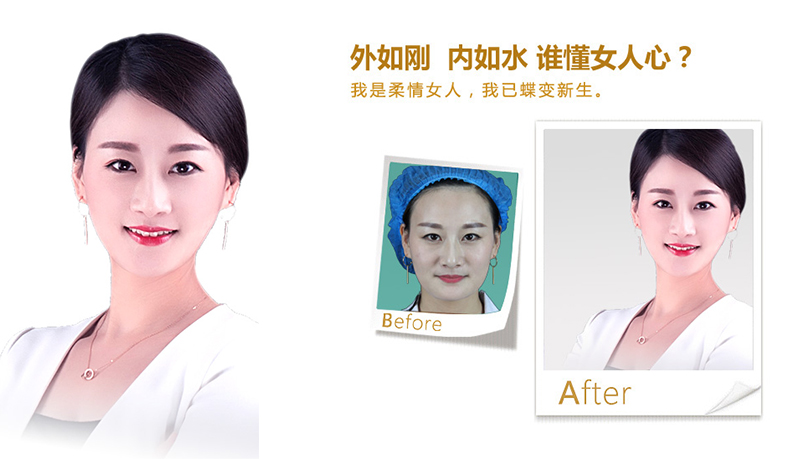 沧州V脸、线雕隆鼻