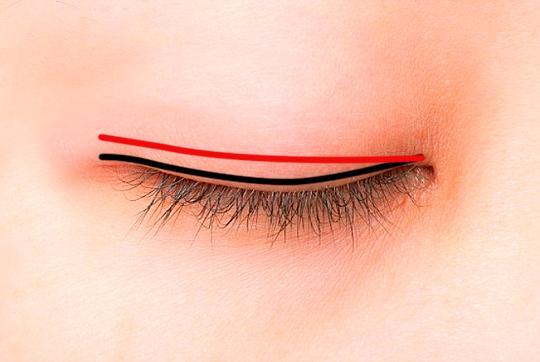 微整形培训哪家好? 微整形培训